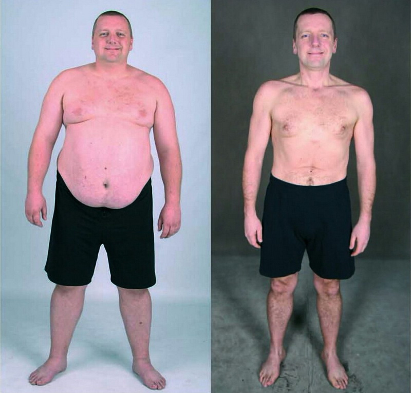 “Зважені та щасливі”: як колоритний коломиянин із 152 кг схуд наполовину (фото)