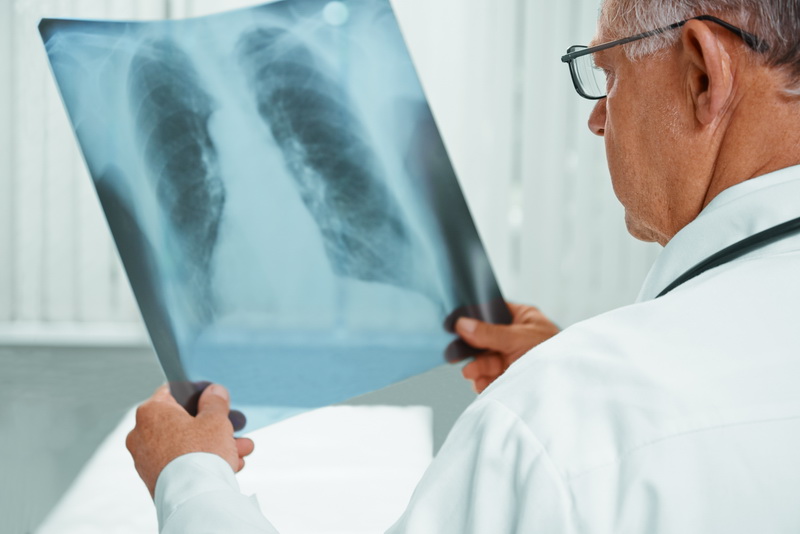 Туберкульоз на Прикарпатті: випадків стало більше