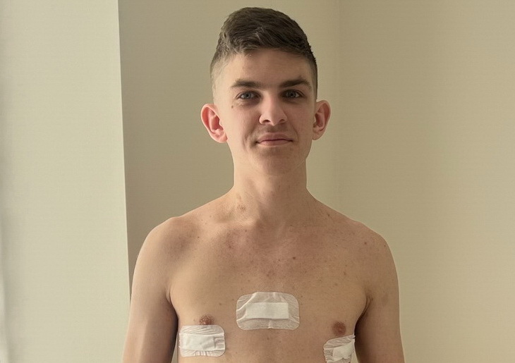 грудна клітка