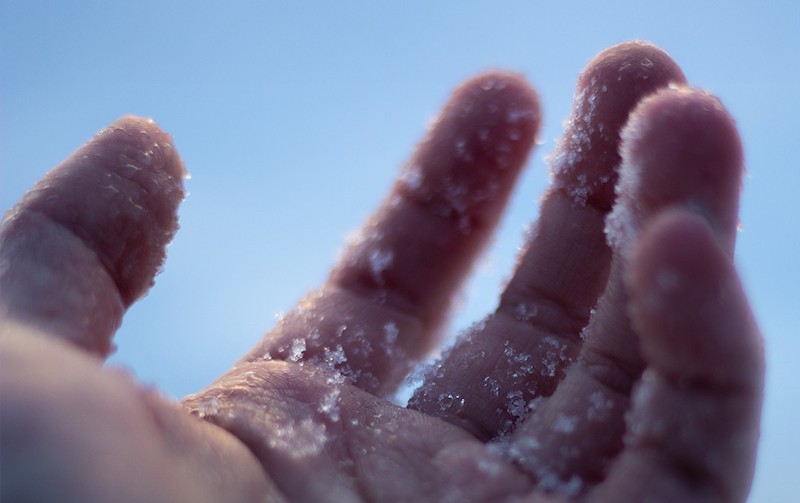 обмороження