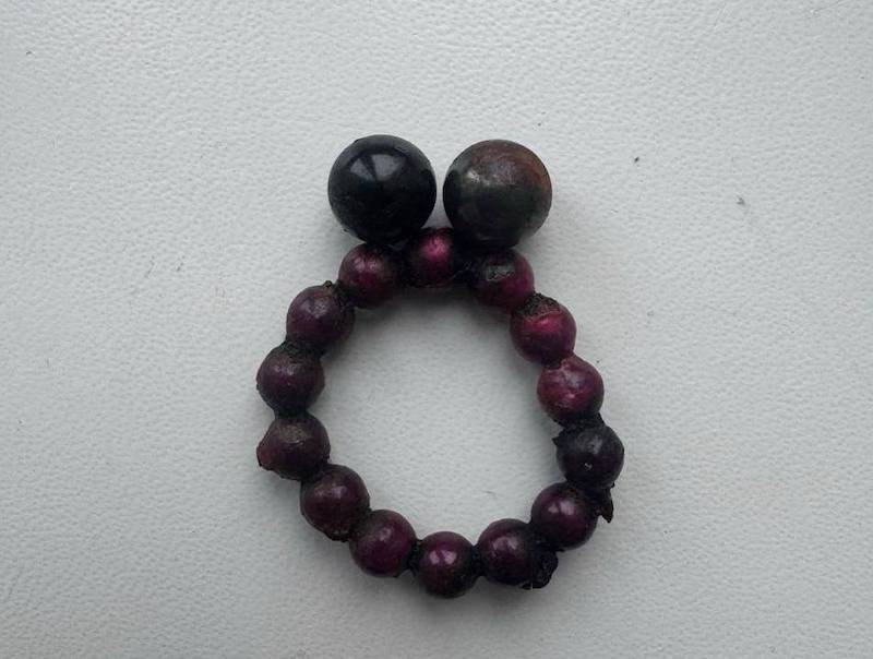 прооперували хлопчика, який проковтнув 17 магнітів