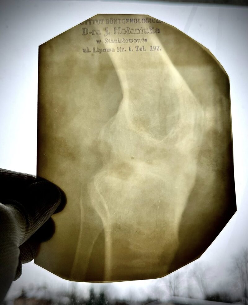 В Івано-Франківську під час роботи з документами працівники державного архіву виявили найдавніший рентгенівський знімок в області, датований 1928 роком