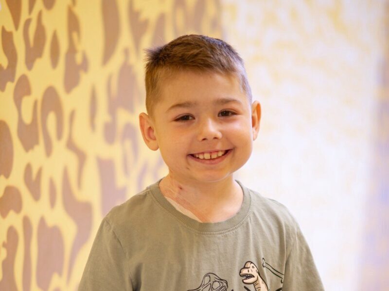 пересадка нирки