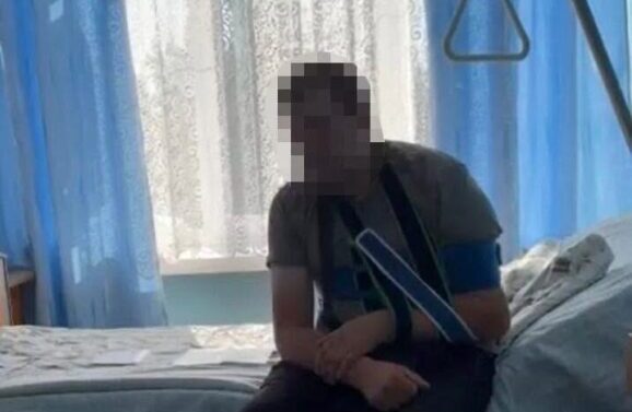 побив